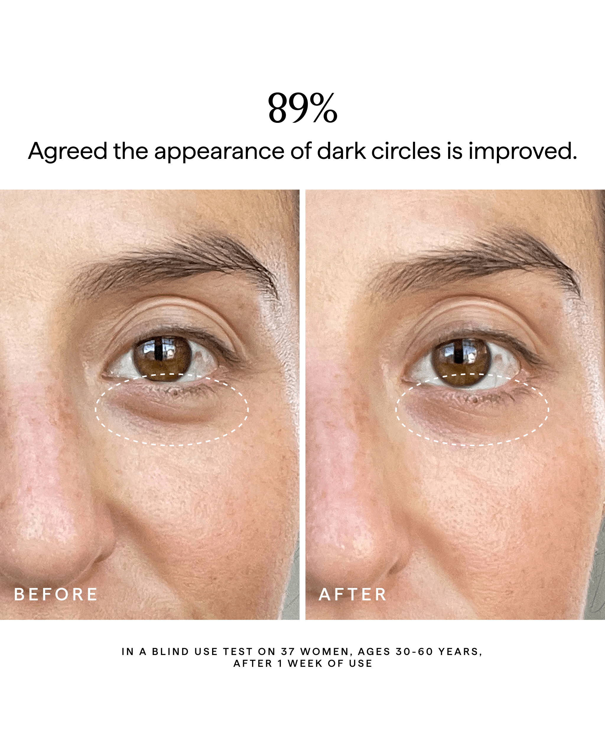 SuperNova_EyeCream_4x5_Carousel_5.png